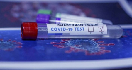 Azərbaycanda indiyədək 1027685 koronavirus testi aparılıb