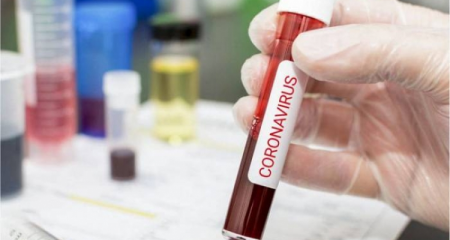 İranda son sutkada koronavirusdan 337 nəfər ölüb