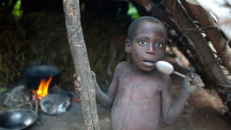 Afrikada yeni yoluxucu xəstəlik - 5 nəfər öldü